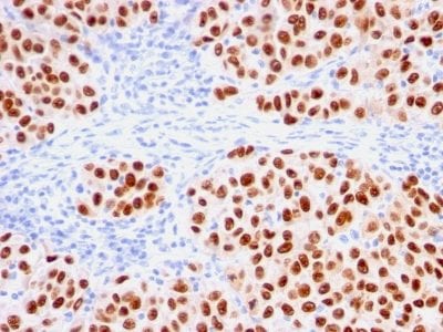 SOX10 Recombinant Monoclonal Mouse Antibody (rSOX10/1074)