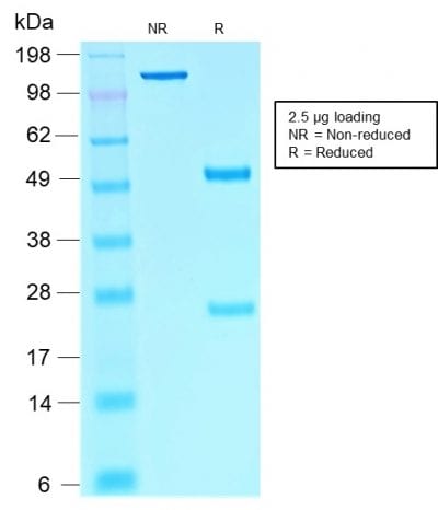 SOX10 Recombinant Monoclonal Mouse Antibody (rSOX10/1074)