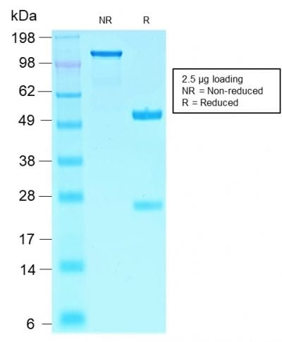 SOX10 Recombinant Monoclonal Rabbit Antibody (SOX10/2311R)