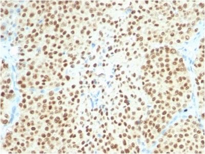 SOX10 Recombinant Monoclonal Rabbit Antibody (SOX10/2311R)