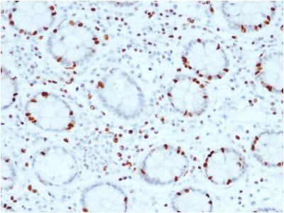 SOX4 Monoclonal Mouse Antibody (SOX4/2540)