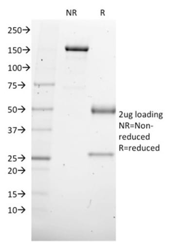 SOX4 Monoclonal Mouse Antibody (SOX4/2540)