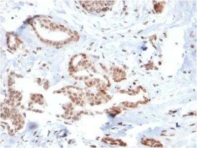 SOX4 Monoclonal Mouse Antibody (SOX4/2540)