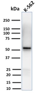 Spastin Monoclonal Mouse Antibody (Sp 6C6)