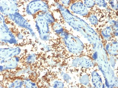 Spectrin Alpha 1 Monoclonal Antibody (SPTA1/1810)
