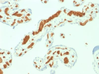 Spectrin Alpha 1 Monoclonal Mouse Antibody (SPTA1/1832)