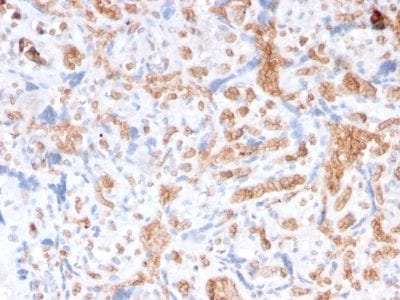 Spectrin Alpha 1 Recombinant Monoclonal Mouse Antibody (rSPTA1/1833)