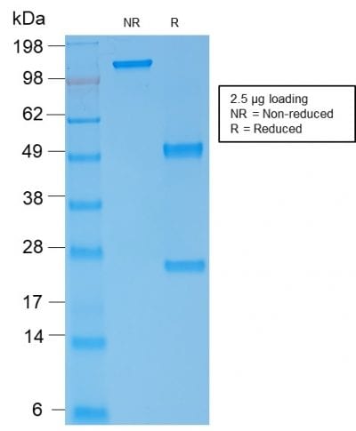 Spectrin Alpha 1 Recombinant Monoclonal Mouse Antibody (rSPTA1/1833)