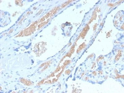 Spectrin Alpha 1 Recombinant Monoclonal Rabbit Antibody (SPTA1/2939R)