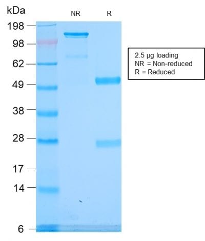 Spectrin Alpha 1 Recombinant Monoclonal Rabbit Antibody (SPTA1/2939R)