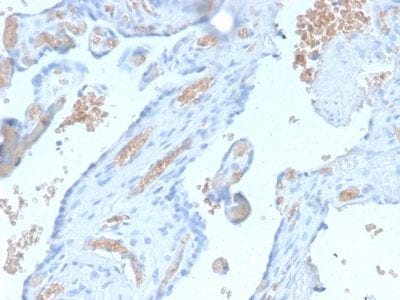 Spectrin Alpha 1 Recombinant Monoclonal Rabbit Antibody (SPTA1/2939R)