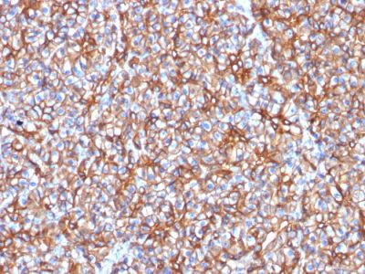 Spectrin Beta III Monoclonal Mouse Antibody (SPTBN2/1778)