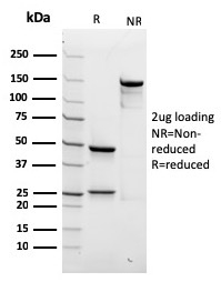 Spectrin Beta III Recombinant Monoclonal Mouse Antibody (rSPTBN2/1778)