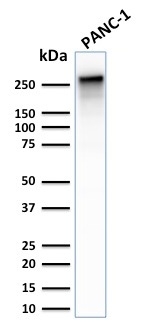 Spectrin Beta III Recombinant Monoclonal Rabbit Antibody (SPTBN2/2887R)