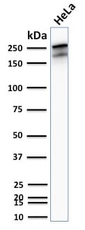 Spectrin Beta III Recombinant Monoclonal Rabbit Antibody (SPTBN2/2894R)