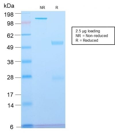 Spectrin Beta III Recombinant Monoclonal Rabbit Antibody (SPTBN2/2894R)