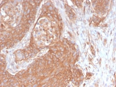 Spectrin Beta III Recombinant Monoclonal Rabbit Antibody (SPTBN2/2894R)