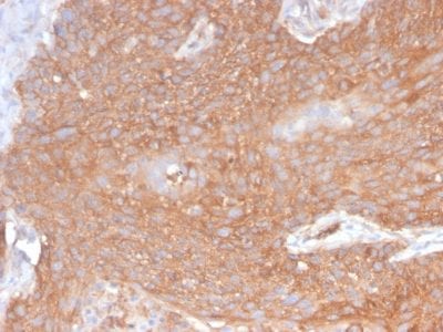 Spectrin Beta III Recombinant Monoclonal Rabbit Antibody (SPTBN2/2894R)
