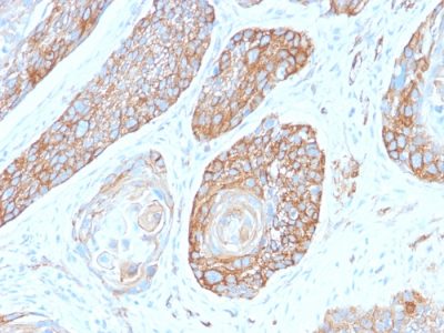 Spectrin Beta III Recombinant Monoclonal Rabbit Antibody (SPTBN2/2979R)