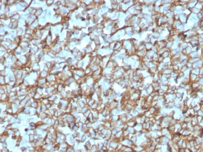 Spectrin Beta III Recombinant Monoclonal Rabbit Antibody (SPTBN2/3142R)