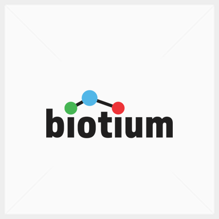 Spectrin Beta-III Monoclonal Mouse Antibody (SPTBN2/1584)