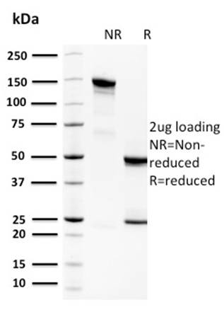 Spermidine or Spermine N1-Acetyltransferase 1 Monoclonal Mouse Antibody (CPTC-SAT1-3)