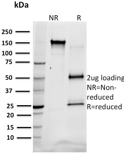 SREBP1 Monoclonal Mouse Antibody (SREBP1/1578)