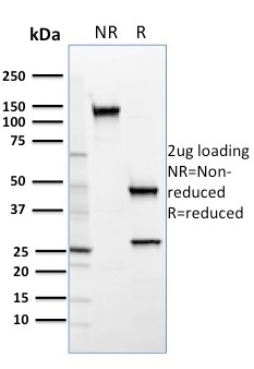 SREBP2 Monoclonal Mouse Antibody (SREBP2/1579)