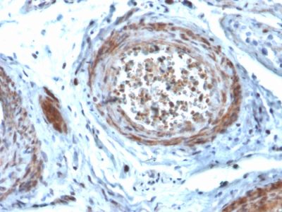 StAR Monoclonal Mouse Antibody (STAR/2077)