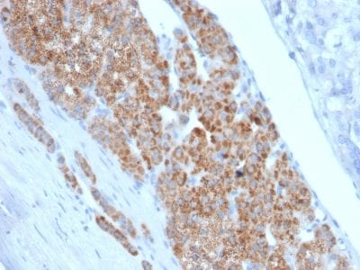 StAR Monoclonal Mouse Antibody (STAR/2140)
