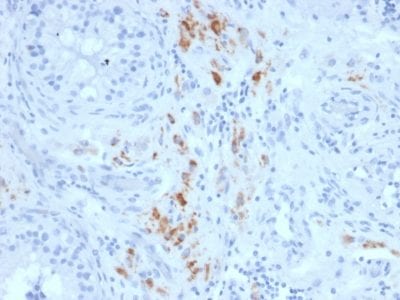 StAR Monoclonal Mouse Antibody (STAR/2140)