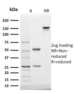 StAR Monoclonal Mouse Antibody (STAR/2140)