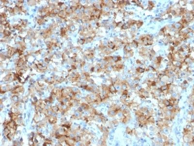 StAR Monoclonal Mouse Antibody (STAR/2154)