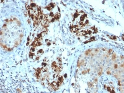 StAR Monoclonal Mouse Antibody (STAR/2154)