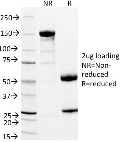 StAR Monoclonal Mouse Antibody (STAR/2154)