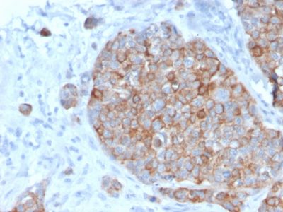 STAT2 Monoclonal Mouse Antibody (STAT2/2650)