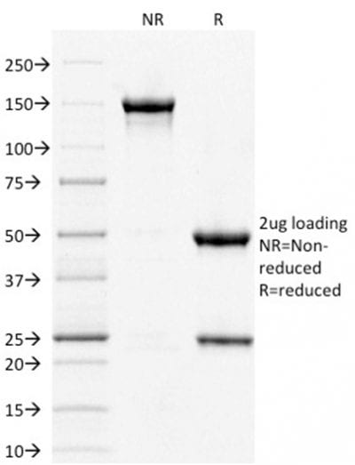 STAT3 Monoclonal Mouse Antibody (PCRP-STAT3-2F12)