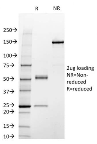 STAT3 Monoclonal Mouse Antibody (STAT3/2409)