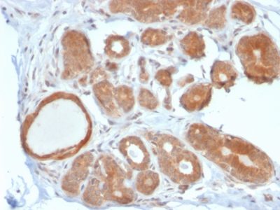 STAT5B Monoclonal Mouse Antibody (STAT5B/2611)
