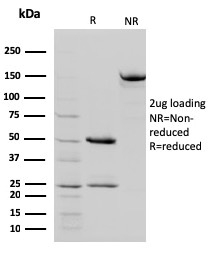 STAT5B Monoclonal Mouse Antibody (STAT5B/2657)