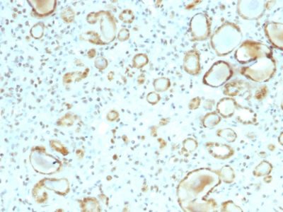 STAT6 Monoclonal Mouse Antibody (STAT6/2410)