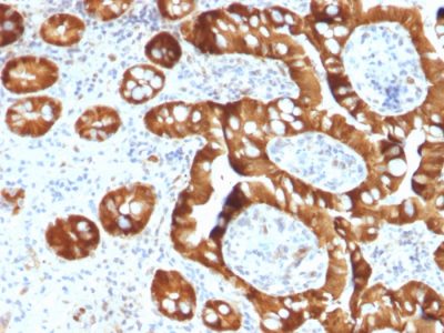 Sulfotransferase family 1E, estrogen-preferring, member 1 Monoclonal Mouse Antibody (CPTC-SULT1E1-1)
