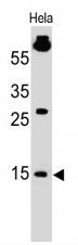 SUMO 1 Monoclonal Mouse Antibody (SM1/495)