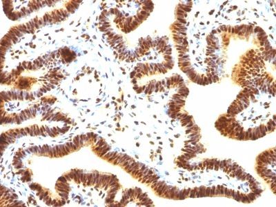SUMO 1 Monoclonal Mouse Antibody (SUMO1/1188)