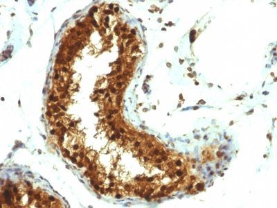 SUMO 1 Monoclonal Mouse Antibody (SUMO1/1188)