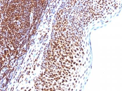 SUMO 1 Monoclonal Mouse Antibody (SUMO1/1188)