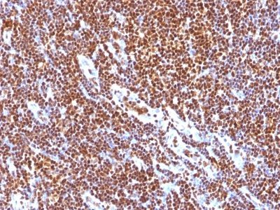 SUMO 1 Monoclonal Mouse Antibody (SUMO1/1188)