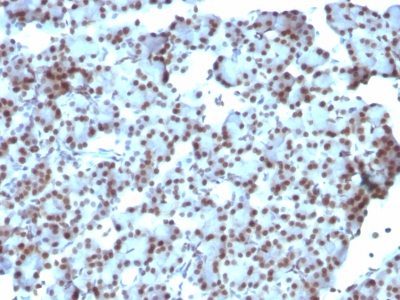 SUMO 1 Monoclonal Mouse Antibody (SUMO1/1188)