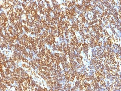 SUMO 2 Monoclonal Mouse Antibody (SUMO2/1199)