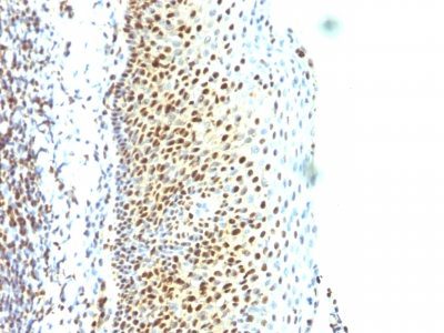 SUMO 2 Monoclonal Mouse Antibody (SUMO2/1199)